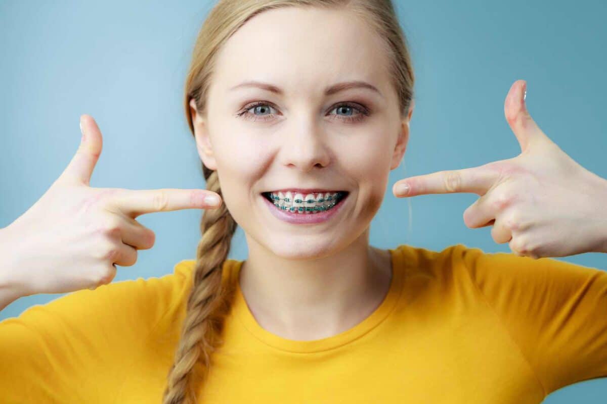 Six Month Braces to Align Teeth at Arcade Dental Pharr, TX