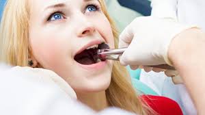 tooth extraction in pharr