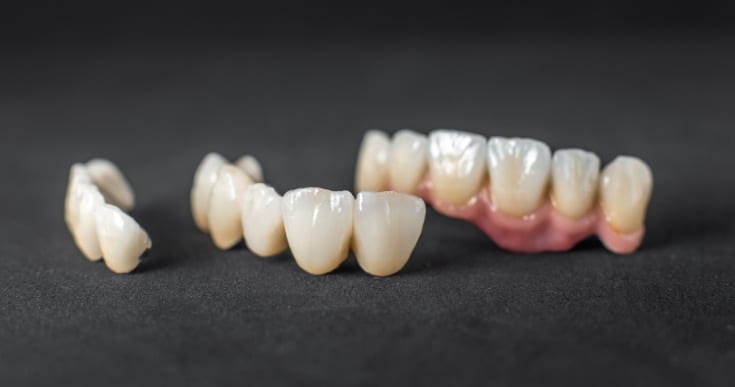 Dental implants can last a lifetime with proper care