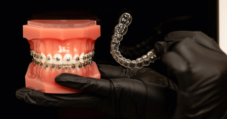 Dental implants can last a lifetime with proper care