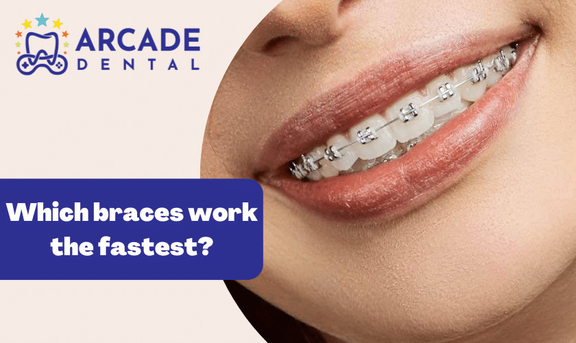 Which braces work the fastest