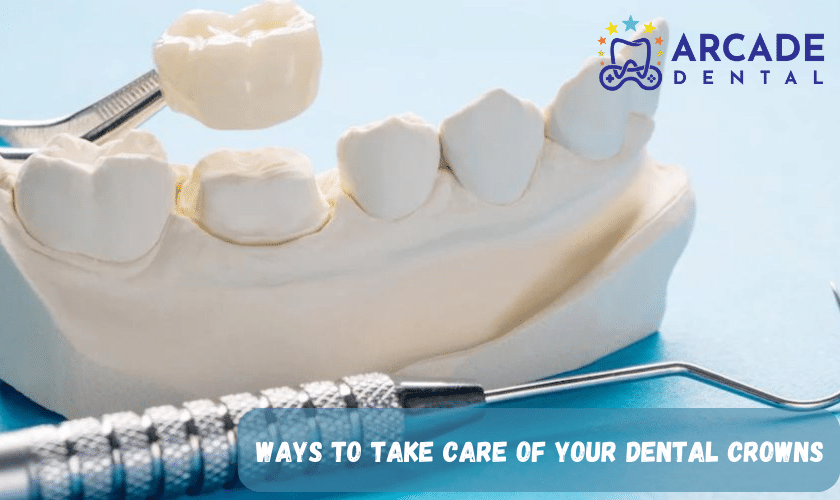 Ways To Take Care Of Your Dental Crowns