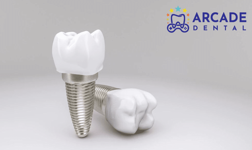 Dental implants can last a lifetime with proper care