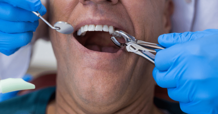 Dental implants can last a lifetime with proper care