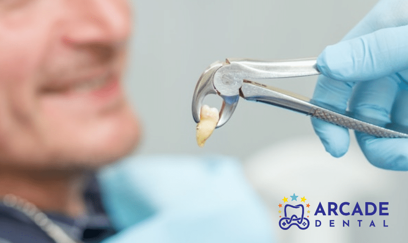 tooth extraction Pharr