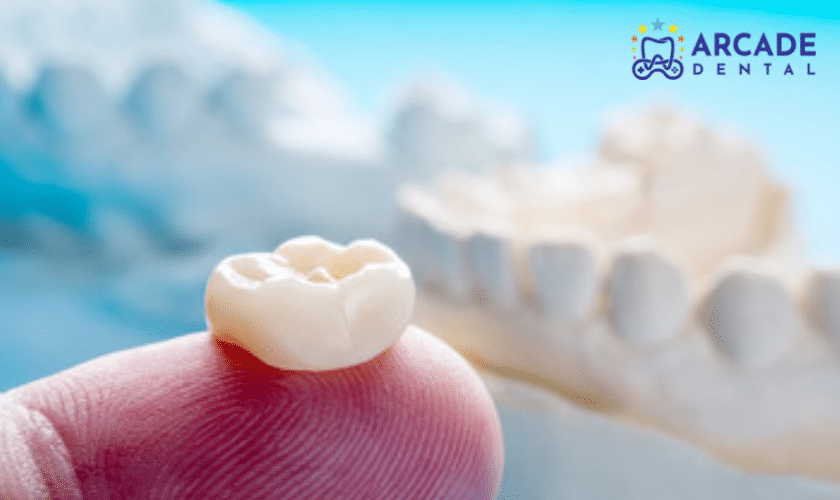 Top 5 Signs That You May Need Dental Crowns