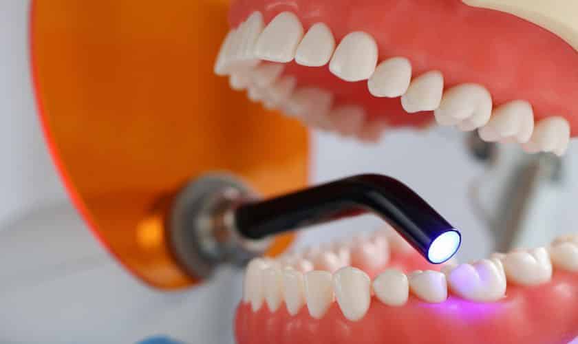 Dental implants can last a lifetime with proper care