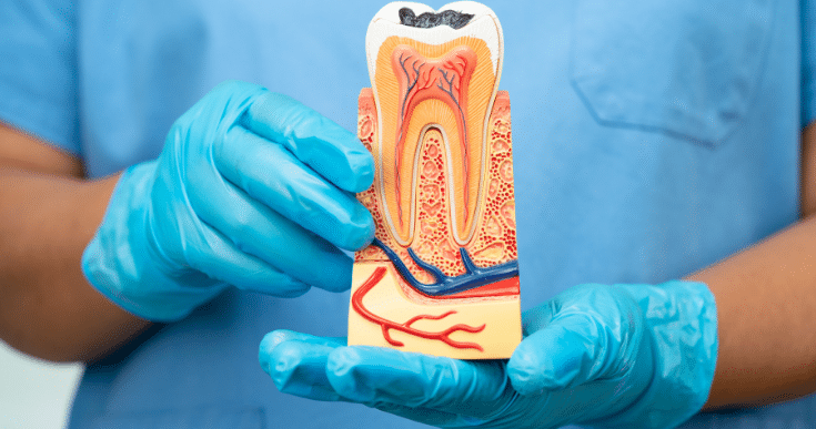 Dental implants can last a lifetime with proper care
