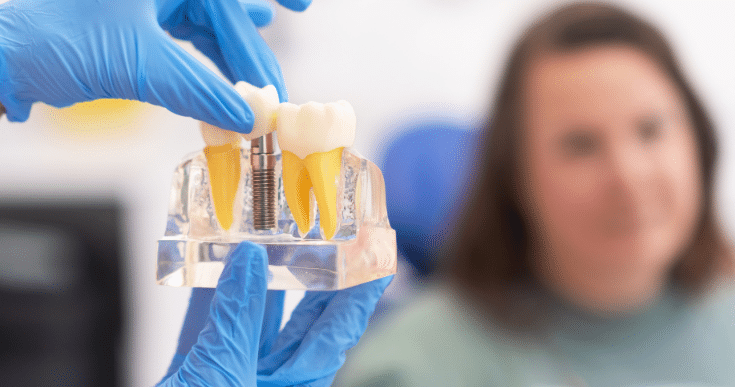 Dental implants can last a lifetime with proper care
