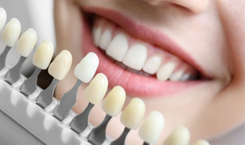 cosmetic dentistry Pharr, TX | Arcade dental Pharr