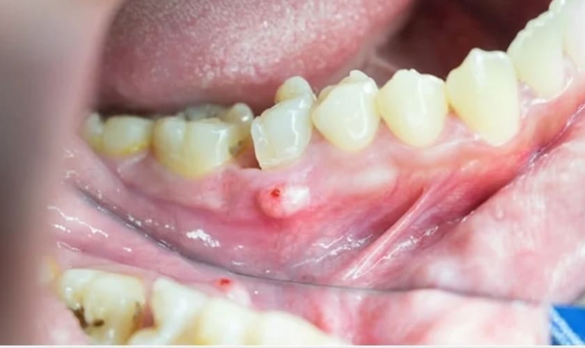 Dentist in Pharr, TX | tooth infection