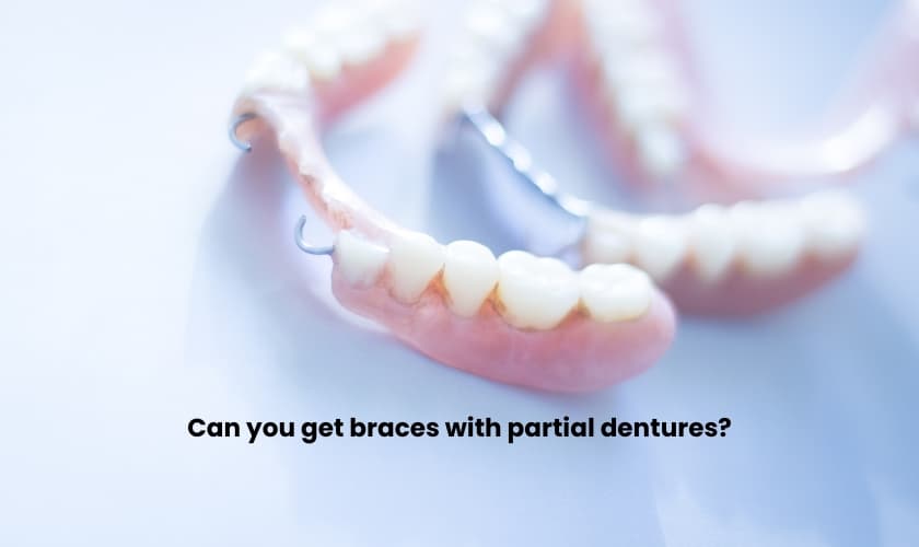 Can you get braces with partial dentures? - Arcade Dental